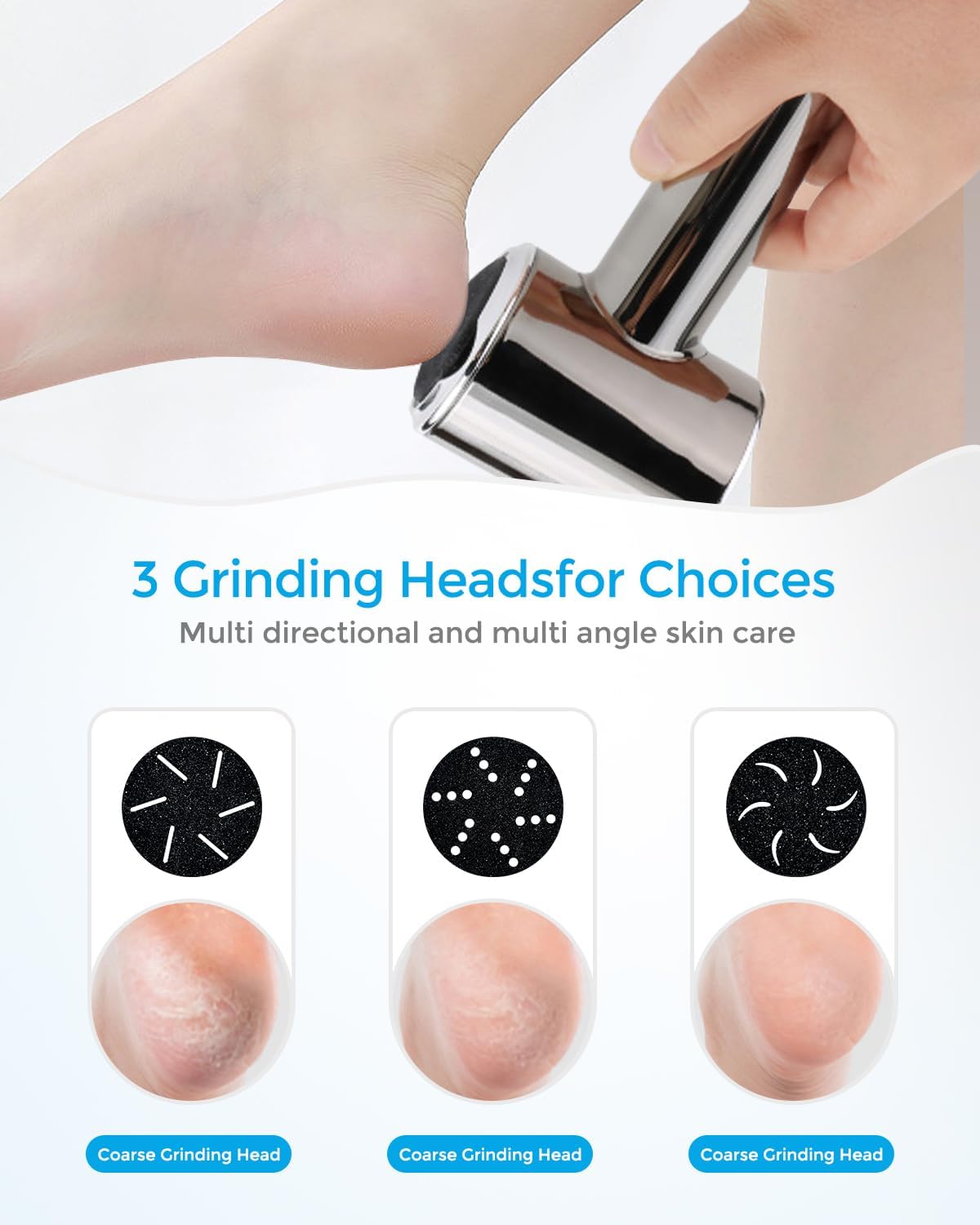 Phonery SoleGlam ® Callus Remover with Dander Vacuum-Getphonery