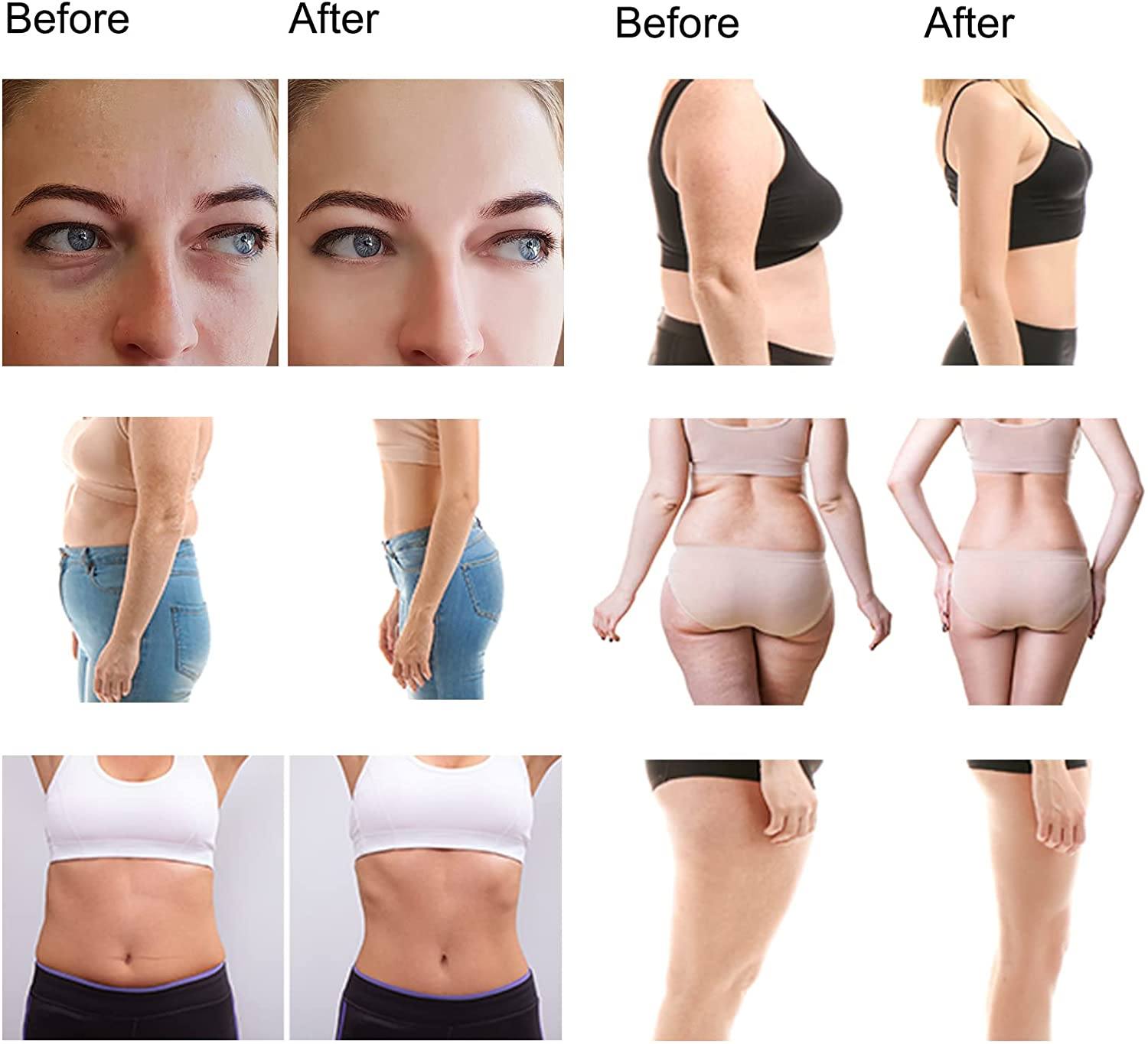 Phonery ShapeX ® Ultrasonic Cavitation Machine-Getphonery