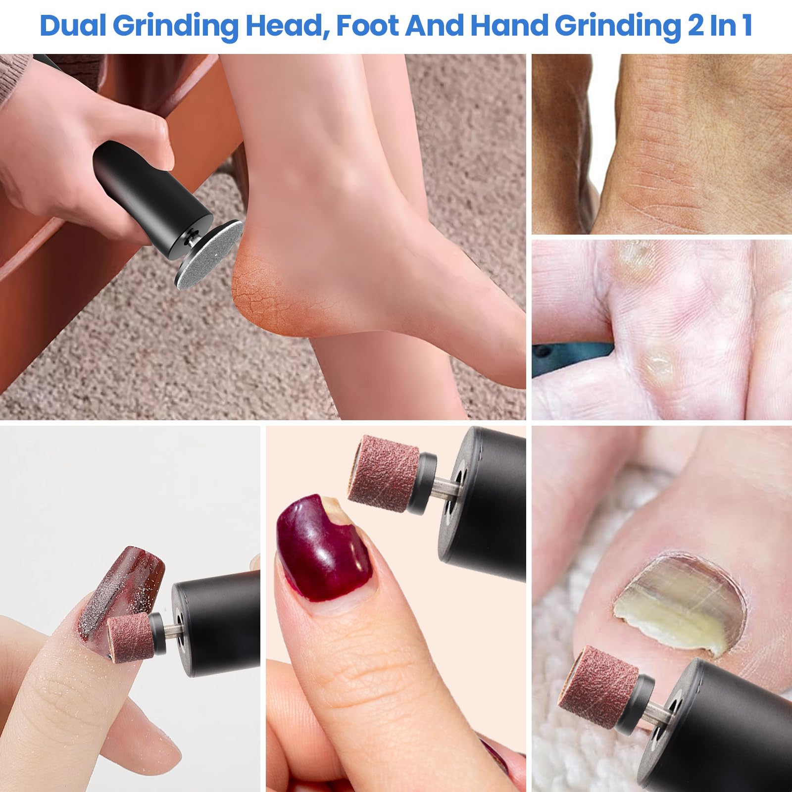 Phonery SilkFeet ® Callus Remover for Feet-Getphonery