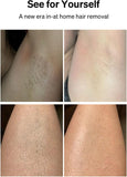 Phonery CrystalSkin ® Laser Hair Removal