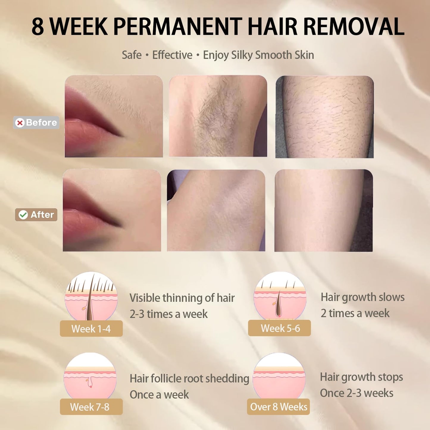 Phonery FrostiTouch ® brazilian laser hair removal