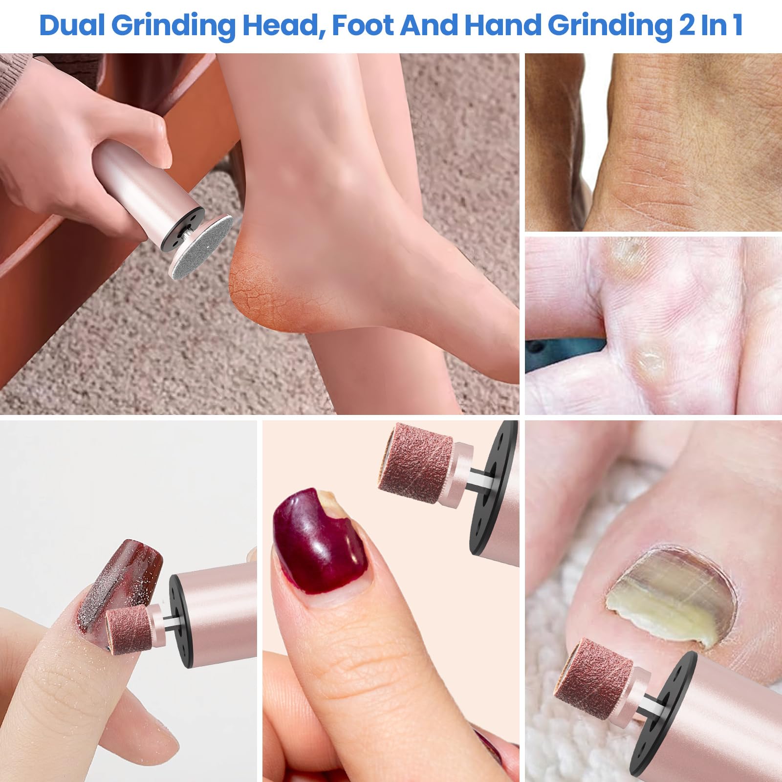 Phonery SilkFeet ® Callus Remover for Feet-Getphonery