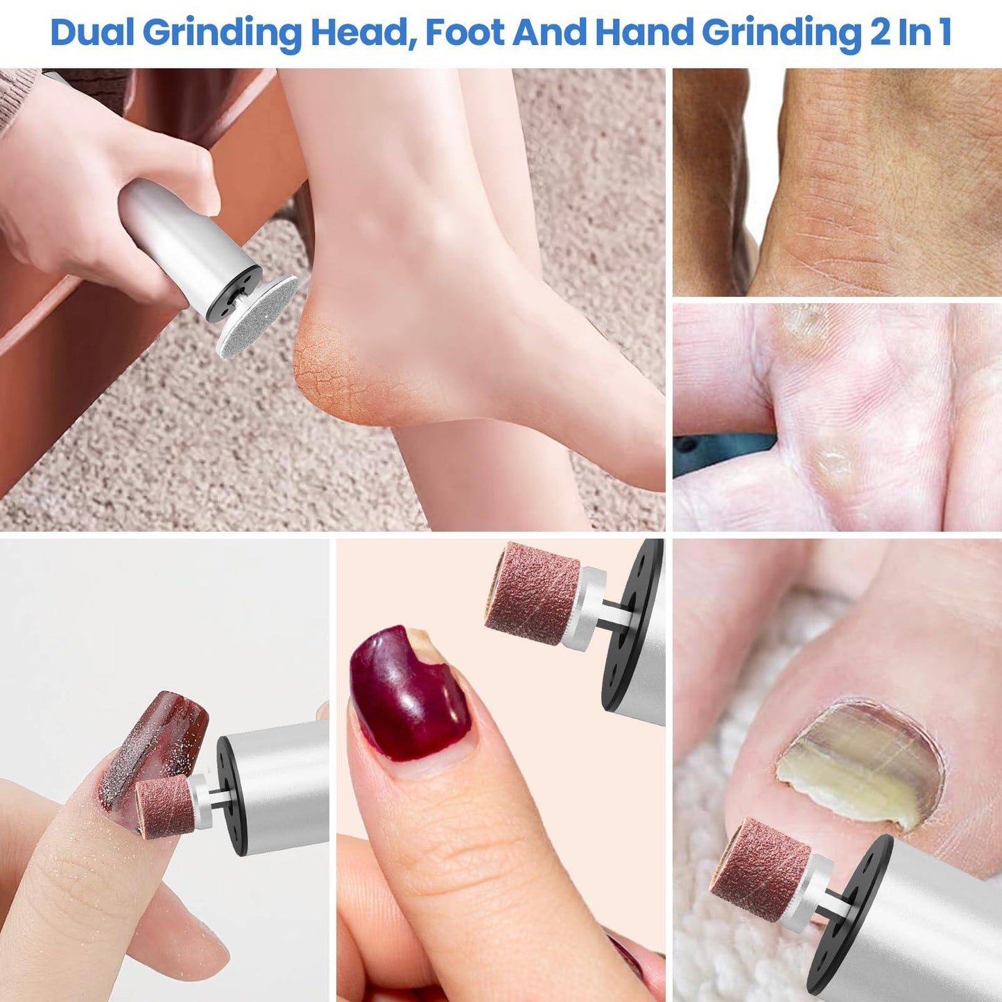 Phonery SilkFeet ® Callus Remover for Feet-Getphonery