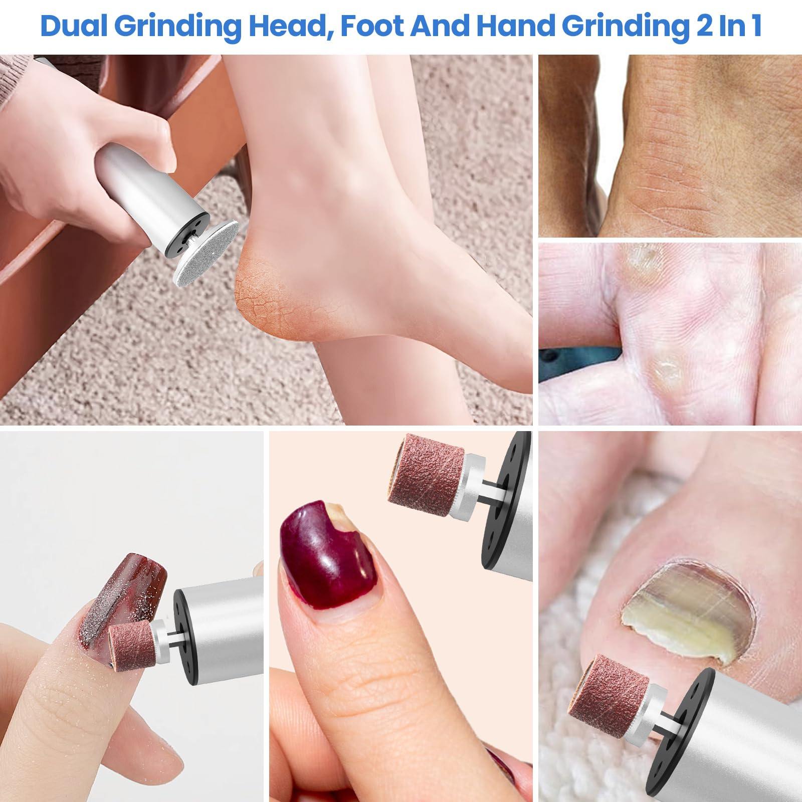 Phonery SilkFeet ® Callus Remover for Feet-Getphonery