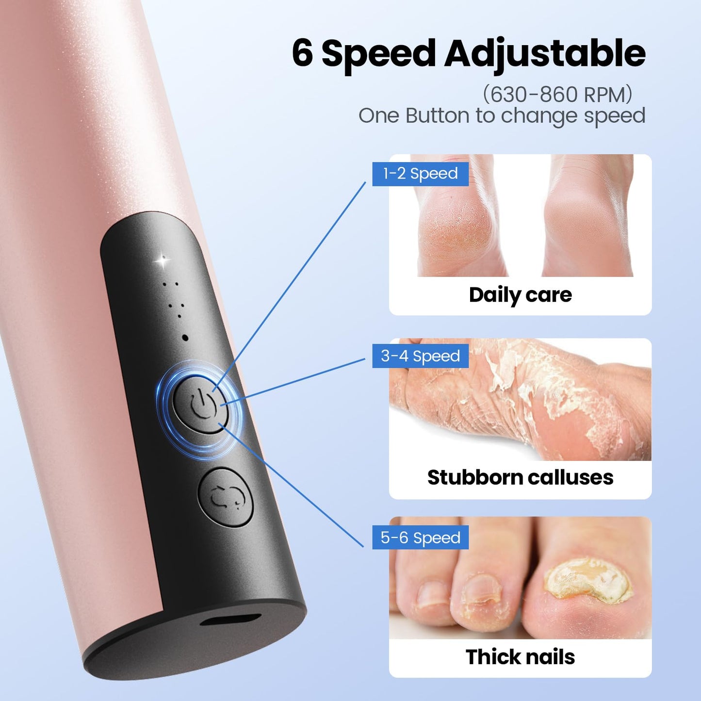 Phonery SilkFeet ® Callus Remover for Feet-Getphonery