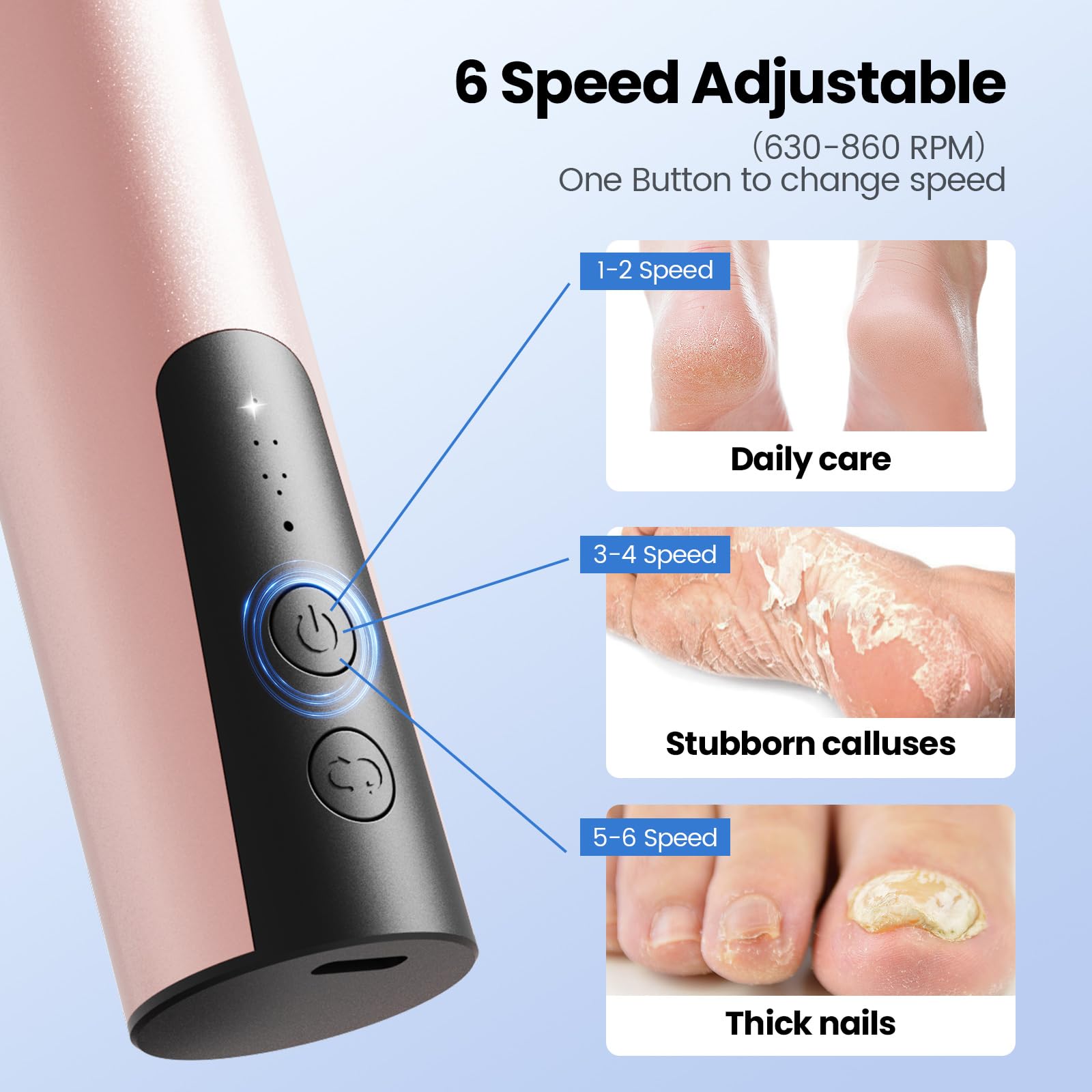 Phonery SilkFeet ® Callus Remover for Feet-Getphonery