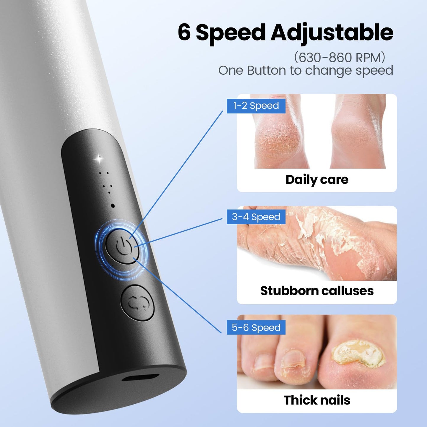 Phonery SilkFeet ® Callus Remover for Feet-Getphonery