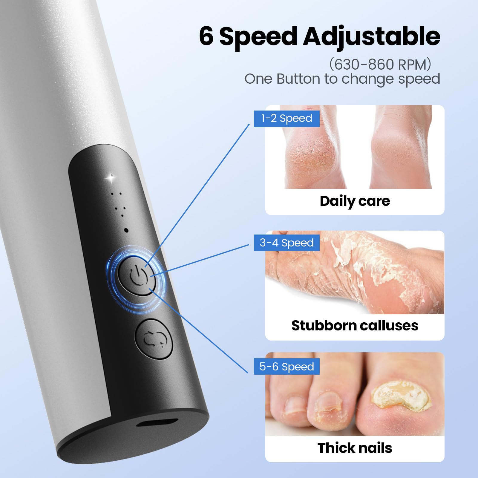 Phonery SilkFeet ® Callus Remover for Feet-Getphonery