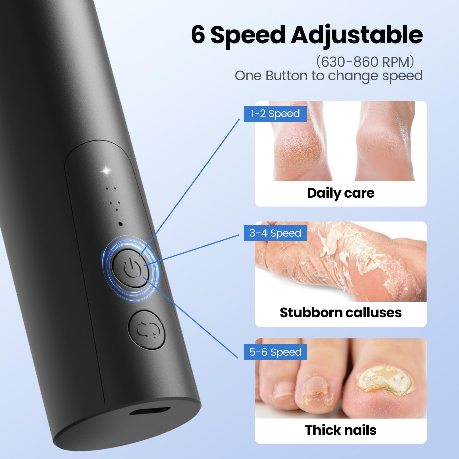 Phonery SilkFeet ® Callus Remover for Feet-Getphonery