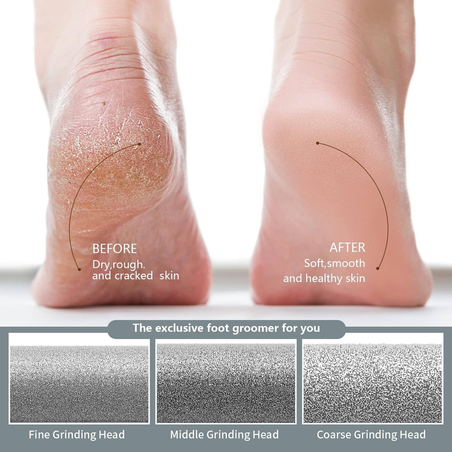 Phonery Scrubz ® Professional Callus Remover-Getphonery