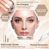 Phonery Plasma ® Skin Tag Remover-Getphonery